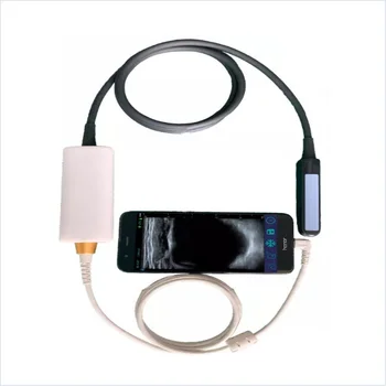 Medicinski Ručni prijenosni rektalni USB ultrazvučna sonda Type C ultrazvučni pretvarač mini-sonar ultrazvučni skener Slika