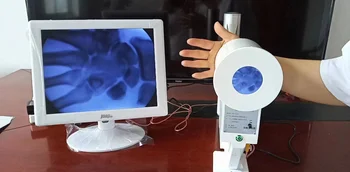 15-inčni led tv zaslonu, prijenosni sustav za rendgensku kontrolu, medicinski флюороскоп Slika
